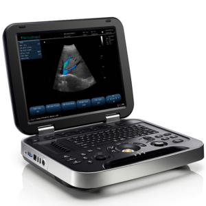 Portable Ultrasound Scanner 15-inch LED display MAS-15L